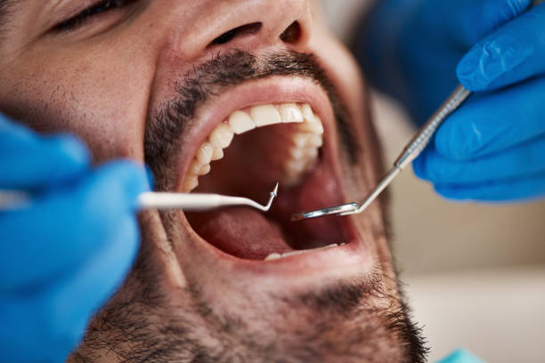Dentist for Dental Trauma in UT